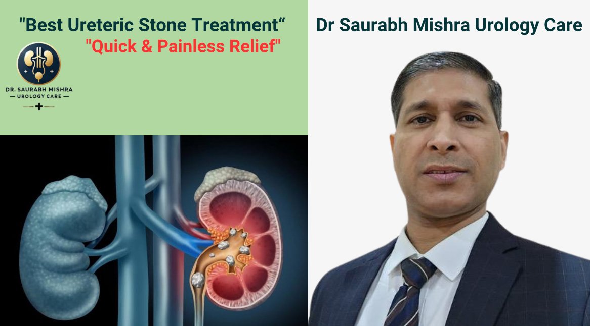 Dr. Saurabh Mishra Urology Care - Best Ureteric Stone Treatment for Quick & Painless Relief. Image featuring a medical illustration of ureteric stones in the kidney and ureter, alongside Dr. Saurabh Mishra, an expert urologist in Delhi.